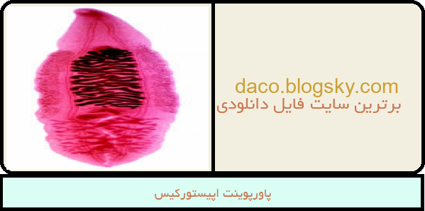 پاورپوینت اپیستورکیس