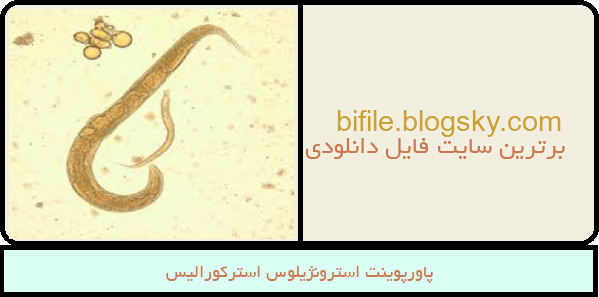 پاورپوینت استرونژیلوس استرکورالیس