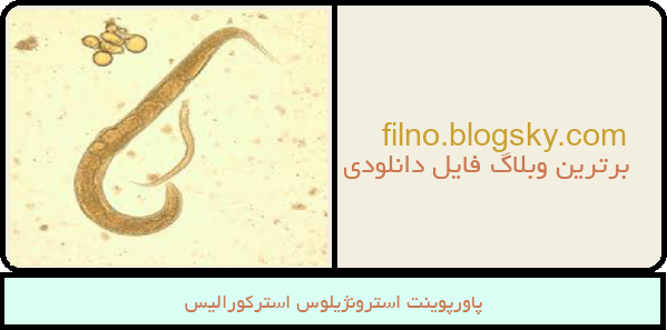 پاورپوینت استرونژیلوس استرکورالیس