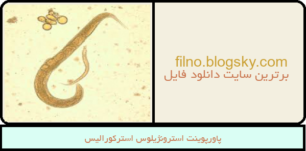 پاورپوینت استرونژیلوس استرکورالیس
