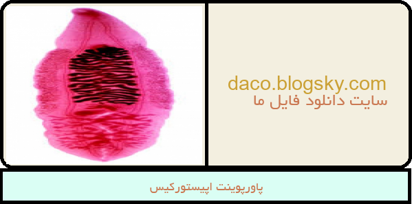 پاورپوینت اپیستورکیس
