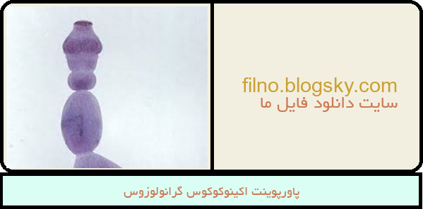 پاورپوینت اکینوکوکوس گرانولوزوس