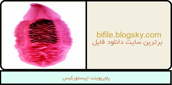 پاورپوینت اپیستورکیس