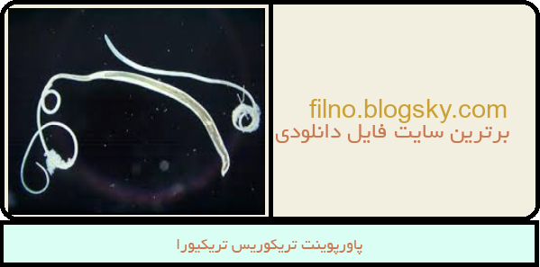 پاورپوینت تریکوریس تریکیورا