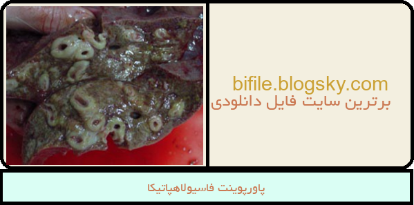 پاورپوینت فاسیولاهپاتیکا