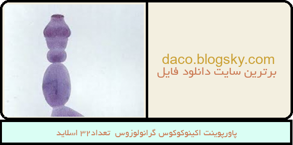 پاورپوینت اکینوکوکوس گرانولوزوس  تعداد32 اسلاید