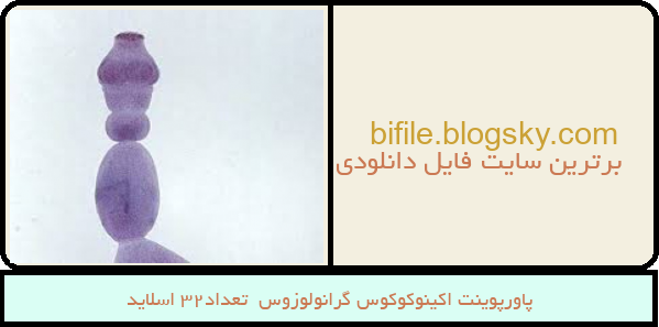 پاورپوینت اکینوکوکوس گرانولوزوس  تعداد32 اسلاید
