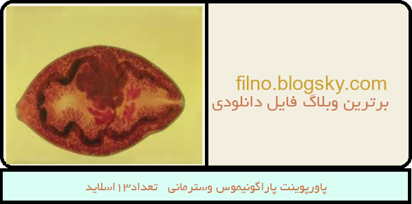 پاورپوینت پاراگونیموس وسترمانی   تعداد13اسلاید