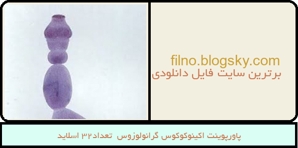 پاورپوینت اکینوکوکوس گرانولوزوس  تعداد32 اسلاید