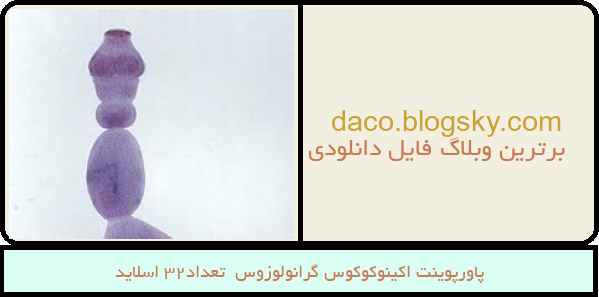 پاورپوینت اکینوکوکوس گرانولوزوس  تعداد32 اسلاید