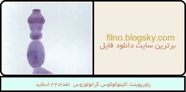 پاورپوینت اکینوکوکوس گرانولوزوس  تعداد32 اسلاید