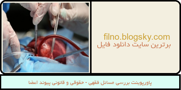پاورپوینت بررسی مسائل فقهی - حقوقی و قانونی پیوند اعضا