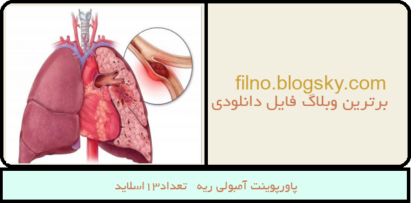 پاورپوینت آمبولی ریه   تعداد13اسلاید