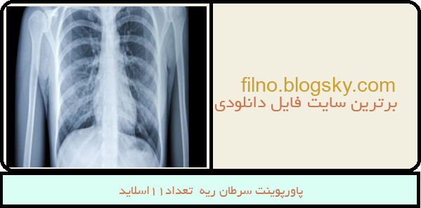 پاورپوینت سرطان ریه  تعداد11اسلاید