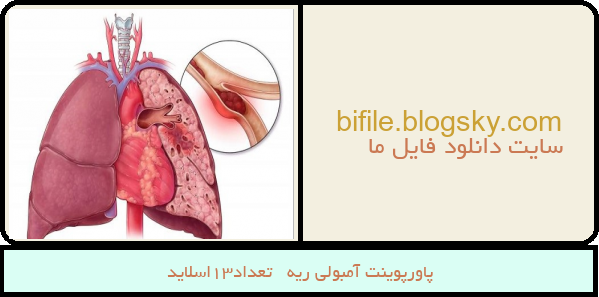 پاورپوینت آمبولی ریه   تعداد13اسلاید