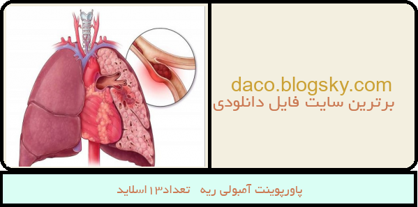 پاورپوینت آمبولی ریه   تعداد13اسلاید